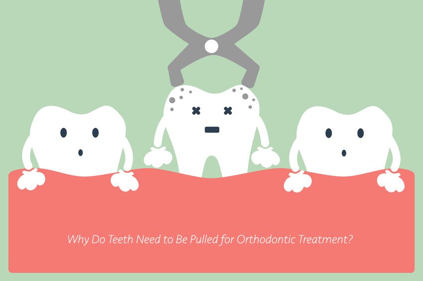 Tooth Extraction cartoon