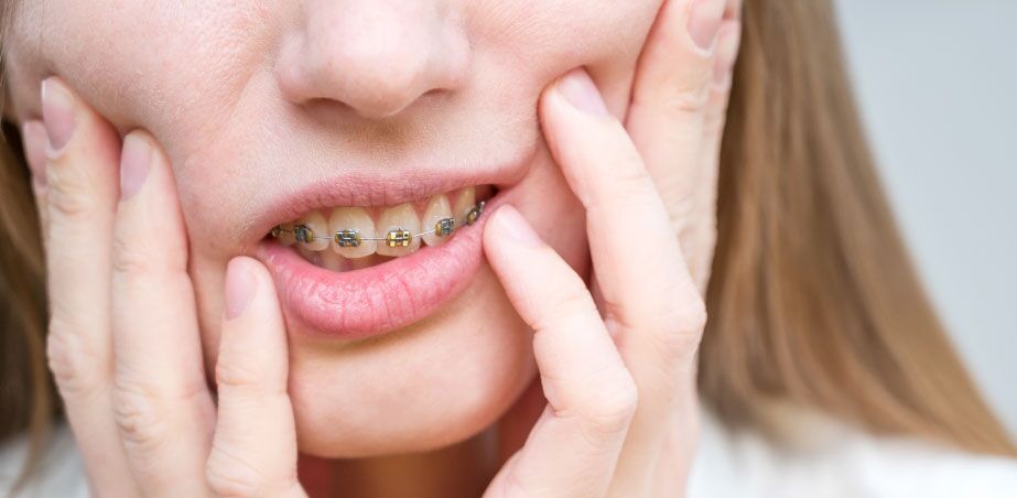 First 5 Days of Having Braces in 2022 | Newpark Orthodontics